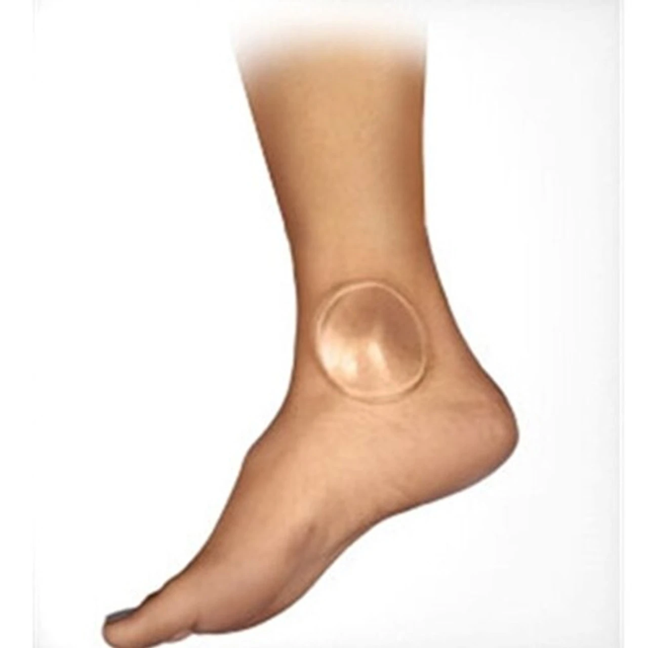 Bunga Gel Disc 1 Bunga Gel Disc